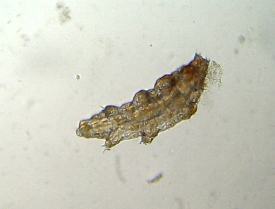 Milnesium Tardigradum.jpg