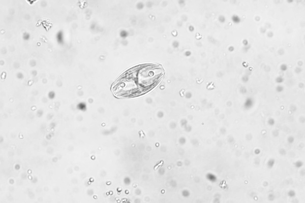 Diatomée 400x 1.jpg