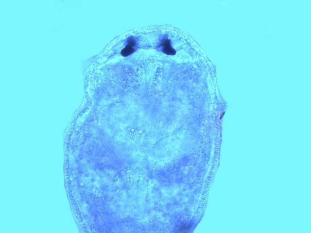 platelminthe4.jpg.cce9ab117a081dc14ae4cb002039f9ba.jpg