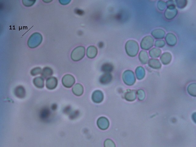 mucorbspores.jpg.7aef41ae3cea305400bca42861ec39a1.jpg