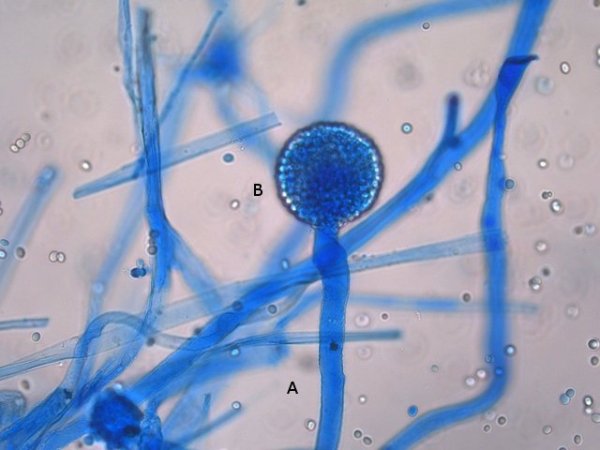 mucor