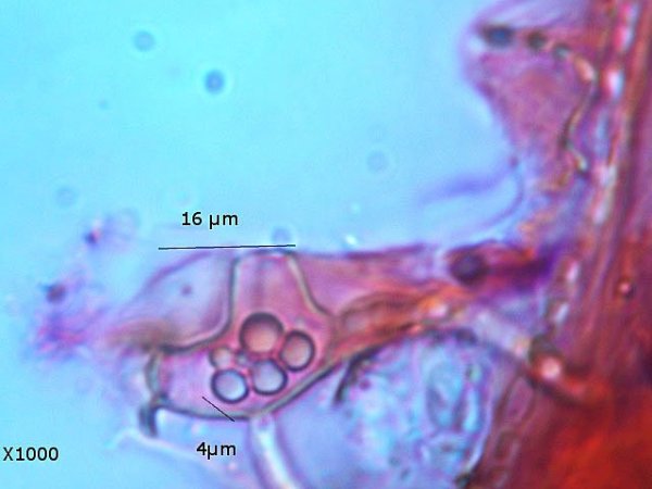 Chlamydospores citrouille moisissure.jpg