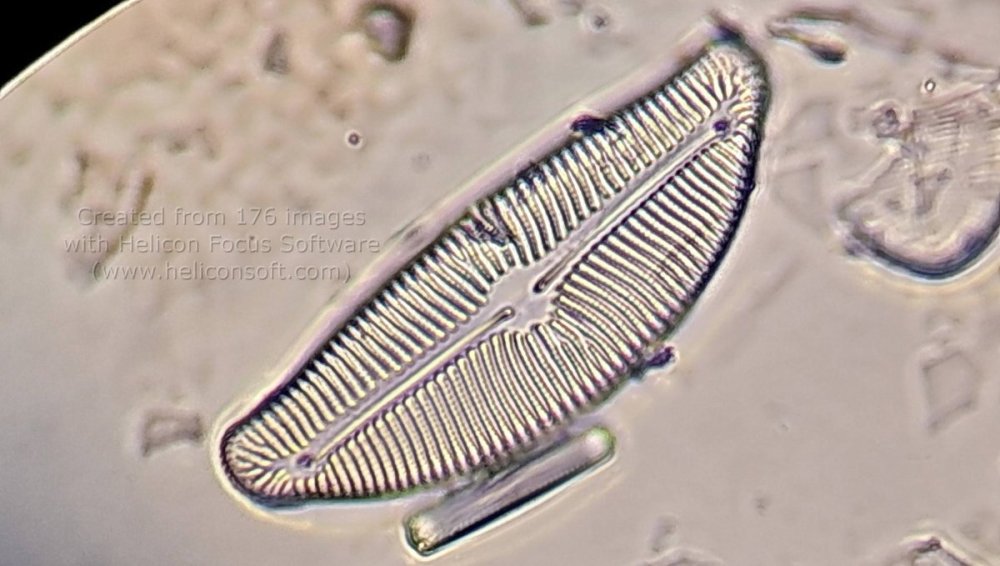 mikro-cymbella-minuta-3.jpg