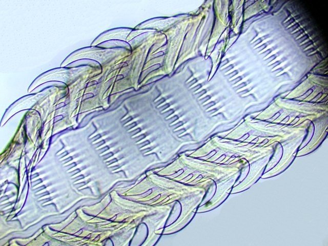 radula_bulot.jpg.f5f0005300c227d78fafe8cfa2e4da10.jpg