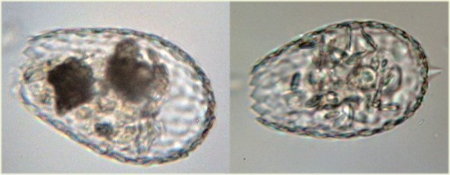 euglypha_denticulata.jpg.2e705ac08ab19b939b7d96ca760afcf4.jpg