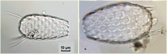 euglyphaacanthophora.jpg.676fff9d911e47d21d7a3df4a762ad61.jpg