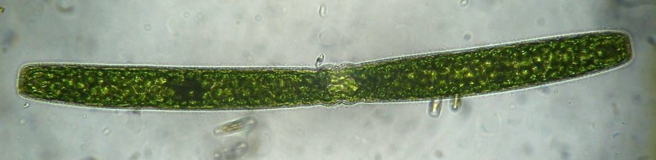 pleurotaenium.JPG.392bb1037c18be170980957700145fc1.JPG