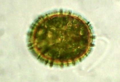 100_2491trachelomonas.JPG.1ae23419cd48260b433478a3613d9722.JPG