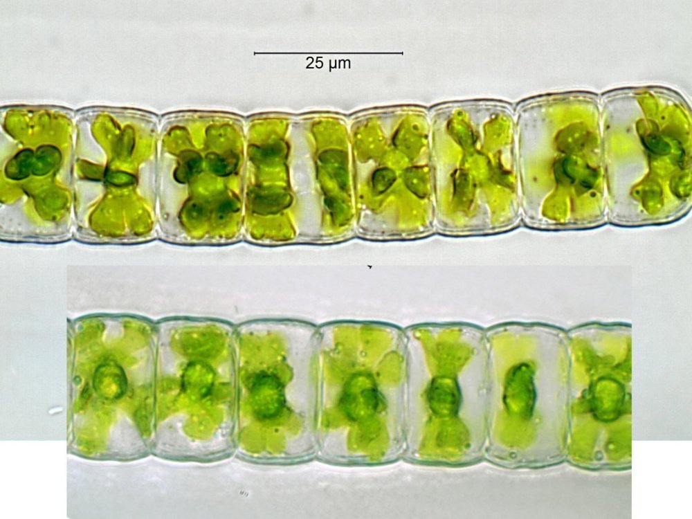 Hyalothecadissilenschloroplasts5.thumb.jpg.e0e2cbcb1a4dce61cf4e85779307baf3.jpg