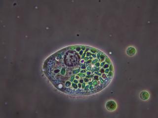 chilodonella_filtered.jpg