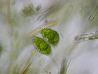 staurastrum_sp.jpg