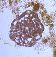 microcystis.jpg