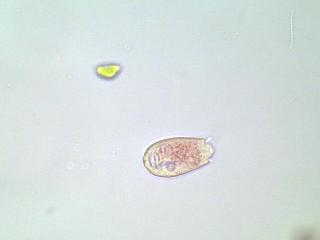 vortctelotrochlarvaX40for.jpg